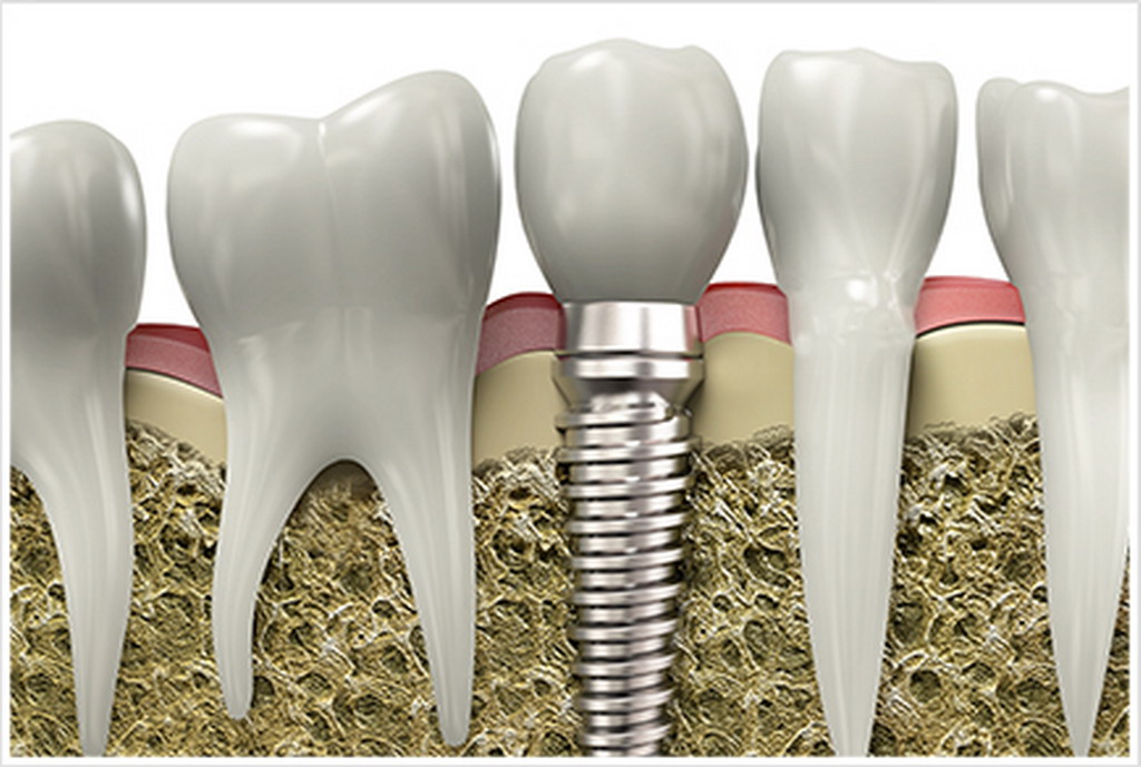 和泉市はつが野・さかぐち歯科医院