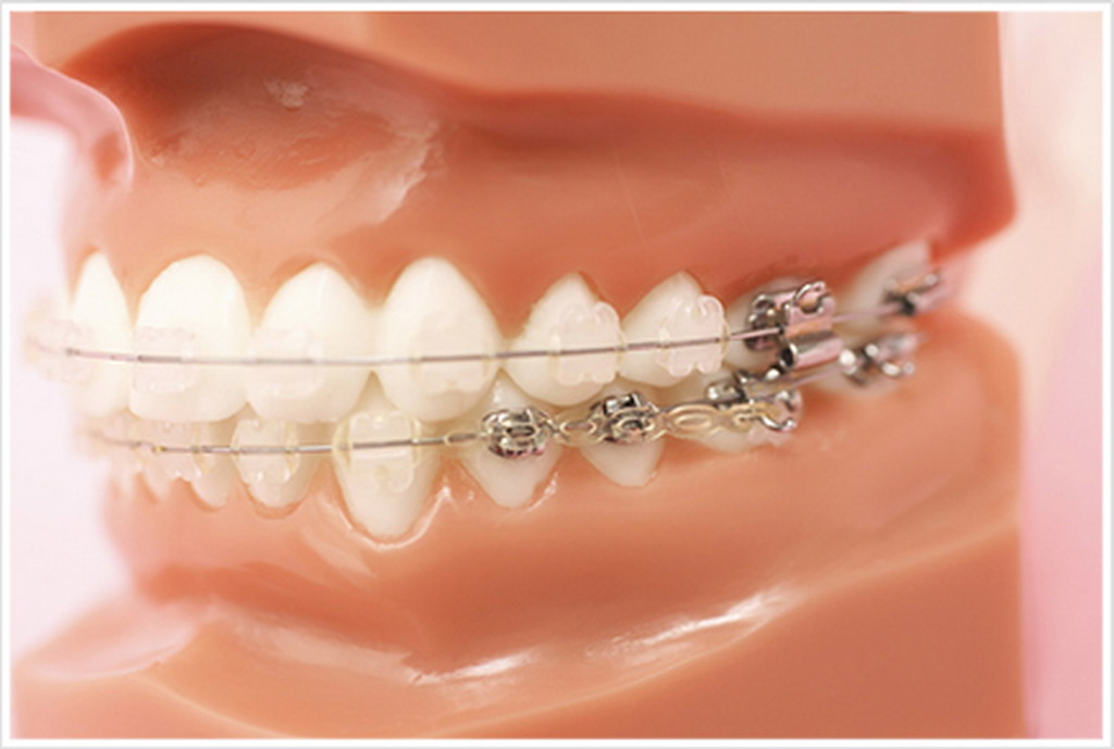 和泉市はつが野・さかぐち歯科医院